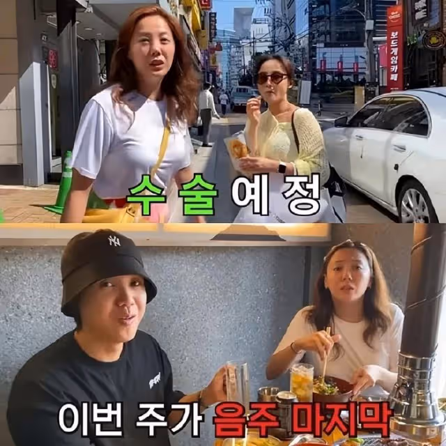 韓國女星承認鼻子手術,費用是一輛中級轎車價格,幾個月不能喝酒