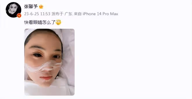 張馨予戴大美瞳引爭議,網友吐槽其製造恐慌,本人委屈回應後秒刪