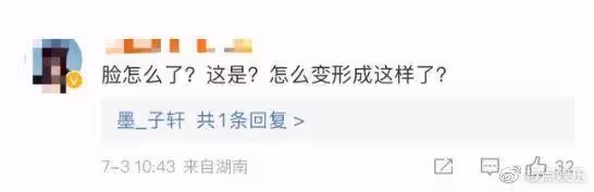 蕭亞軒自爆已單身!身形暴瘦臉部扭曲,被狗咬臉後,凹陷嘴歪認不出
