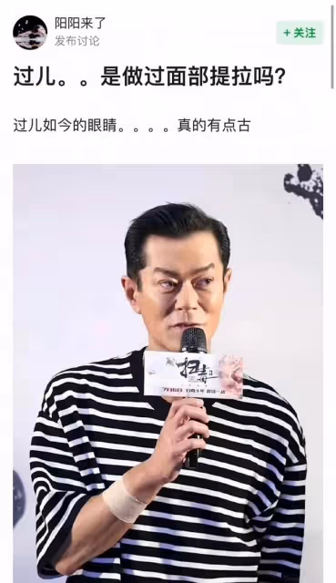古天樂出席活動惹爭議,表情猙獰吊眼角,疑似面部提拉過度出問題