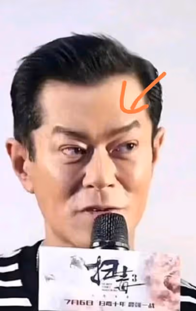 古天樂出席活動惹爭議,表情猙獰吊眼角,疑似面部提拉過度出問題