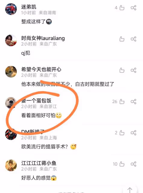 古天樂出席活動惹爭議,表情猙獰吊眼角,疑似面部提拉過度出問題
