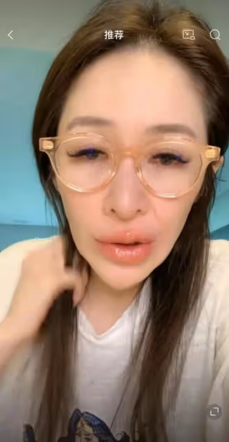 蕭亞軒自曝單身健康引擔憂，面部變形崎嶇不平，網友：很像浪胃仙