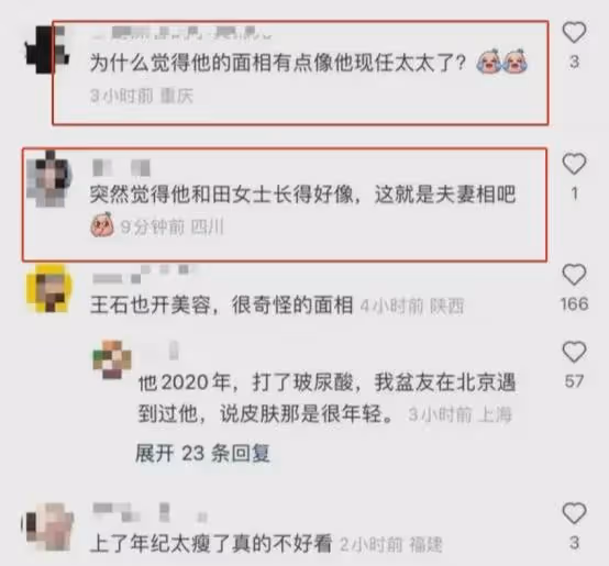 72歲王石直播模樣大變，臉型似42歲妻子田朴珺，斑禿嘴歪引人擔憂