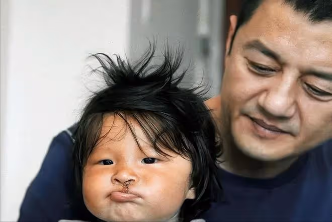 李亞鵬小女夏夏病情疑加重,走起來雙腿不對勁,與姥爺互動慢半拍