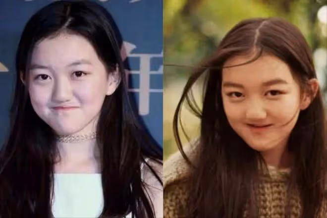 李亞鵬小女夏夏病情疑加重,走起來雙腿不對勁,與姥爺互動慢半拍