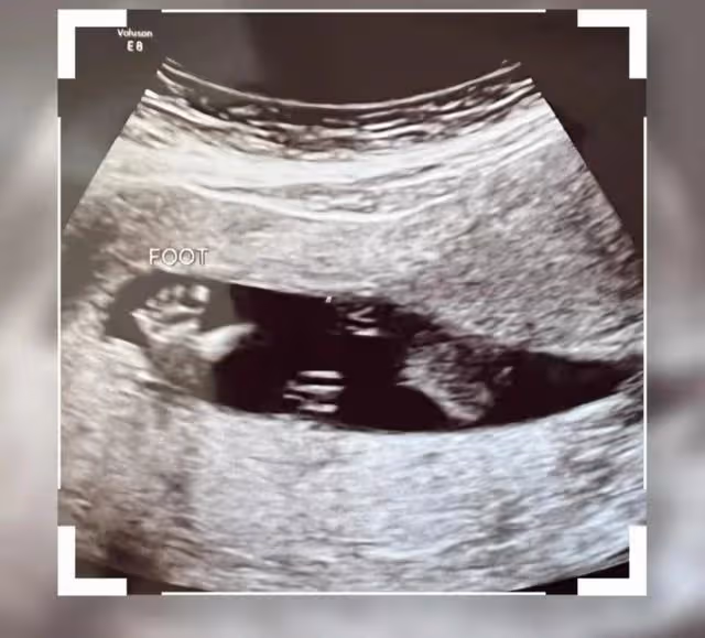 恭喜！港歌手秘密誕子後再度宣布有喜，曾經歷家暴至今仍未敢結婚