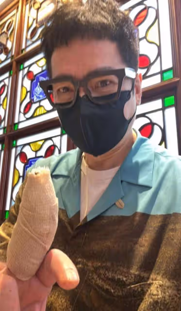 「西門慶」單立文近況引擔憂!受傷4個月仍未痊癒,手指纏滿紗布