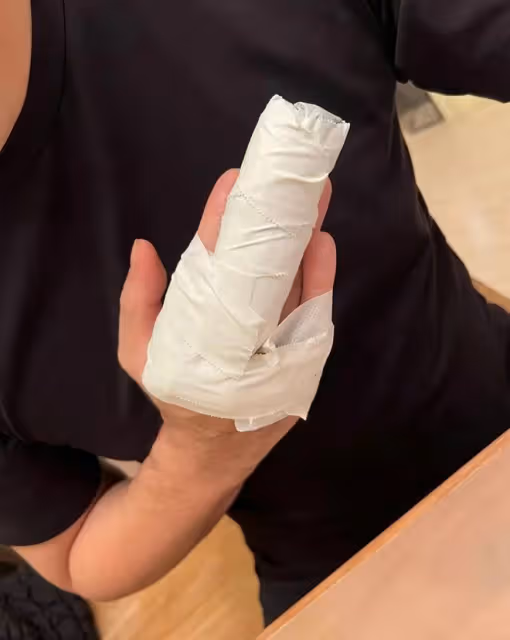 「西門慶」單立文近況引擔憂!受傷4個月仍未痊癒,手指纏滿紗布