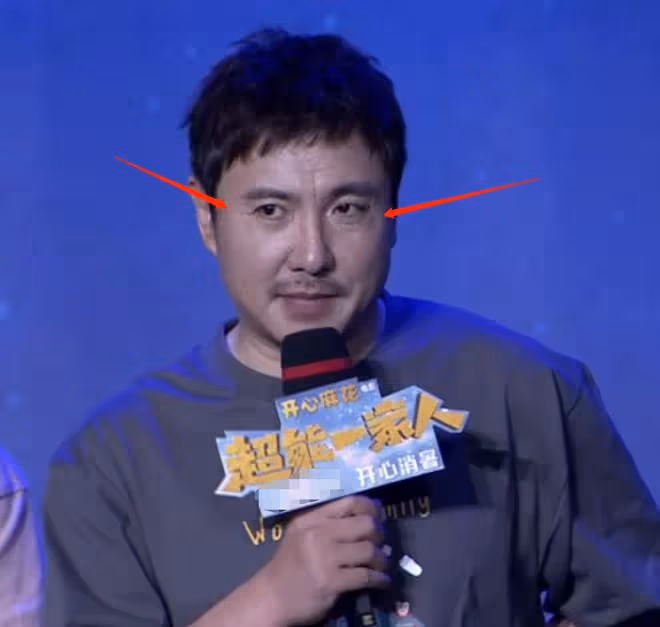 沈騰直播臉色差，身體狀況惹人擔憂，否認生病後每次露面都變瘦