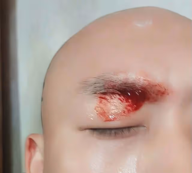 突發!TVB知名男星在內地拍戲不慎受傷,被落地燈擊中血流不止