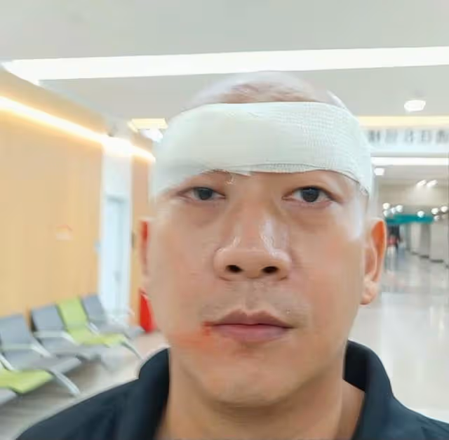 突發!TVB知名男星在內地拍戲不慎受傷,被落地燈擊中血流不止