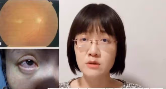 李亞鵬攤上事了!嫣然醫院副院被曝致人傷殘,受害者喊話要求徹查