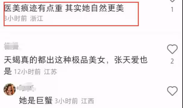 張嘉倪廣州出席活動,說話溫柔舉止優雅,面部緊繃引發爭議