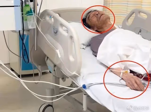 91歲楊少華住院!躺病床面容枯槁骨瘦如柴,多個儀器監護引擔憂
