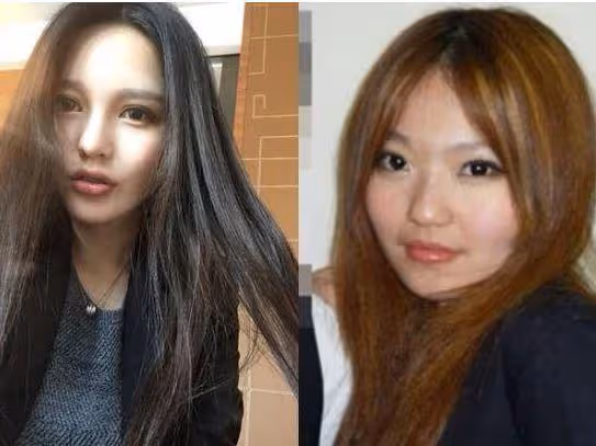 周揚青曬韓國夜店照,面部僵硬蘋果肌腫脹,自曝一晚換兩個場地