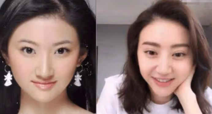 又有網紅整容失敗!從蕭薔、張檬到景甜,美女們別再折騰臉了