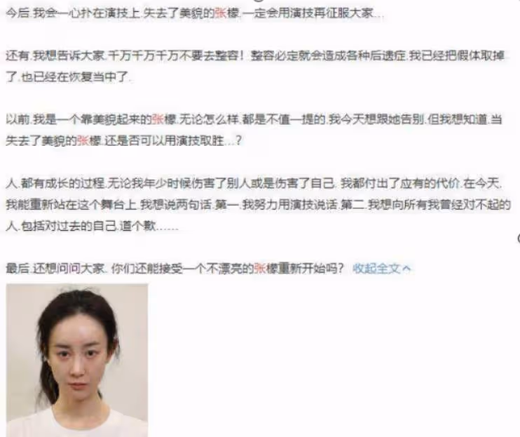又有網紅整容失敗!從蕭薔、張檬到景甜,美女們別再折騰臉了