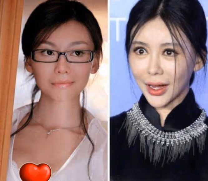 又有網紅整容失敗!從蕭薔、張檬到景甜,美女們別再折騰臉了