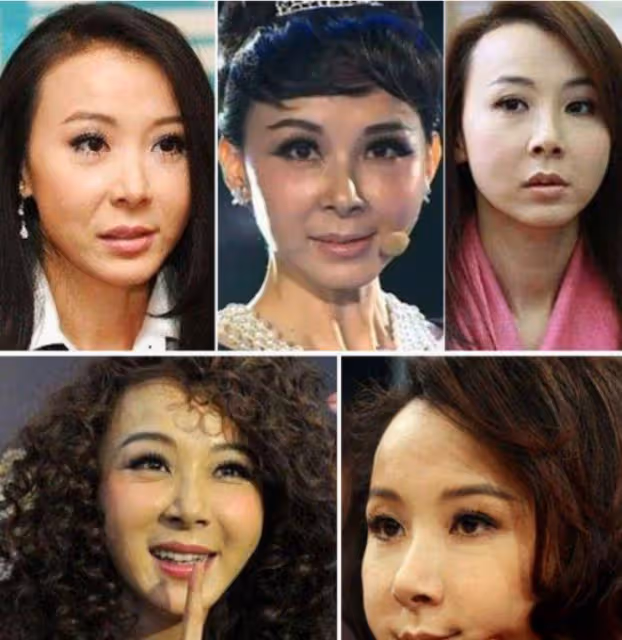 又有網紅整容失敗!從蕭薔、張檬到景甜,美女們別再折騰臉了
