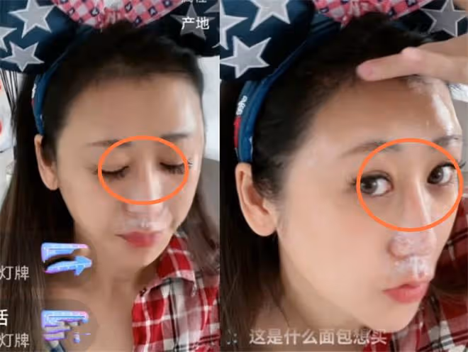 蔣麗莎帶傷直播疑被家暴?下巴淤青、鼻紅腫,曾當眾嫌陳浩民無能