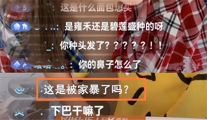 蔣麗莎帶傷直播疑被家暴?下巴淤青、鼻紅腫,曾當眾嫌陳浩民無能