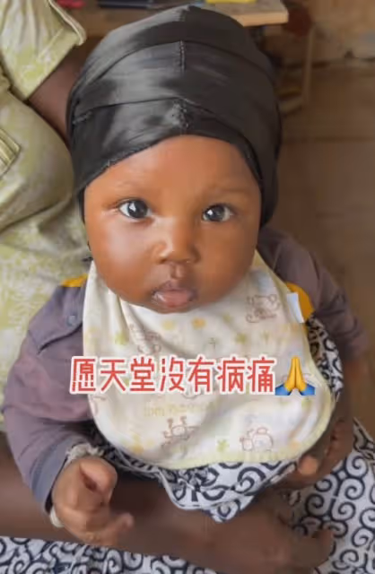 「最小網紅」奧麗去世!得了水痘還洗澡,沒錢拖了近一個月才看病