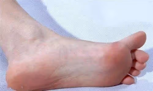 女人壽命長不長!看「腳」就知曉?腳上有「5個特徵」:壽命短不了