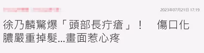 知名男星在美國突發疾病!傷口化膿頭部禿一塊,上月卷性騷擾風波