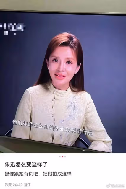 朱迅被疑整容失敗大變樣!嘴歪臉僵撞臉宋小寶,健康狀況令人擔憂