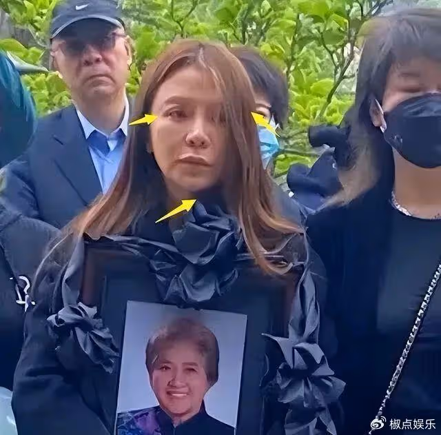朱迅被疑整容失敗大變樣!嘴歪臉僵撞臉宋小寶,健康狀況令人擔憂