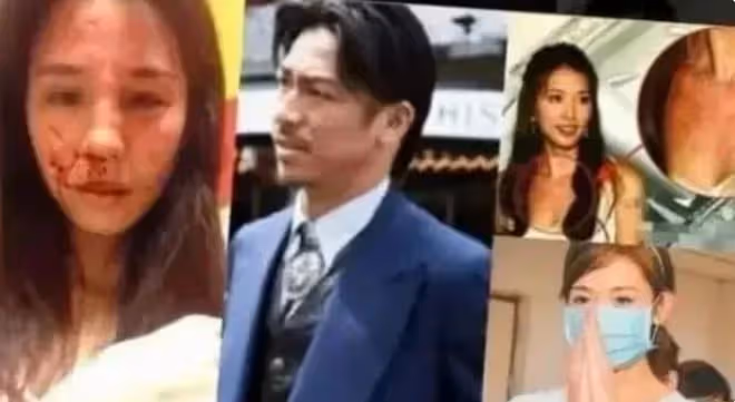 林志玲家暴事件曝光，就醫照片一同曝光！疑似偷吃被逼下跪?