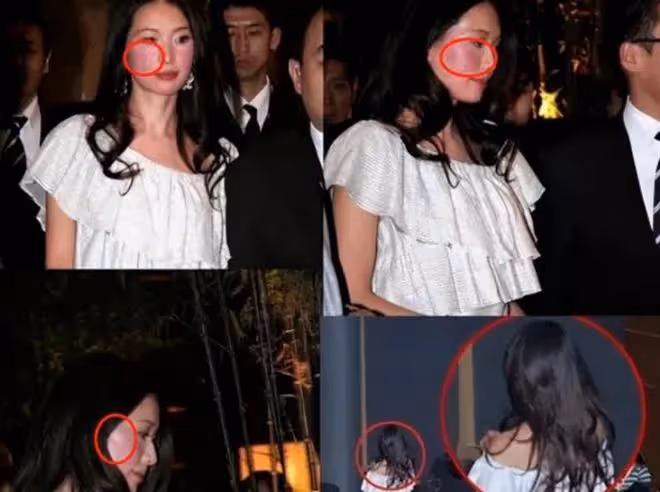 林志玲家暴事件曝光，就醫照片一同曝光！疑似偷吃被逼下跪?