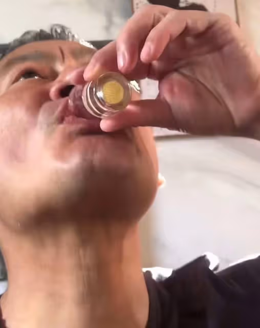 56歲景崗山健康引擔憂!尿酸高仍把酒當水喝,川字紋明顯很憔悴