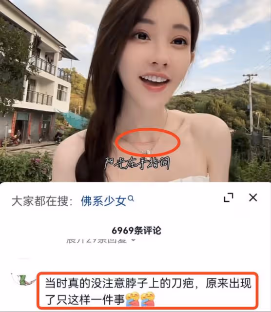 馮提莫回應患甲狀腺癌症晚期：手術很成功，女孩一定不要精神內耗