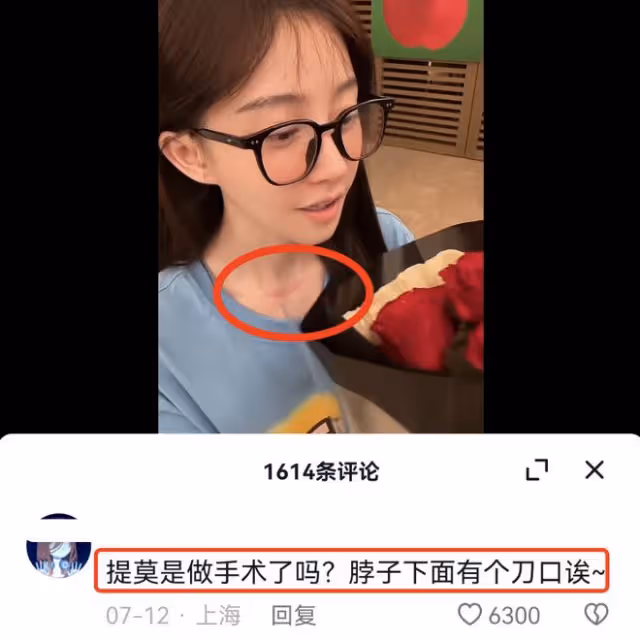 馮提莫回應患甲狀腺癌症晚期：手術很成功，女孩一定不要精神內耗