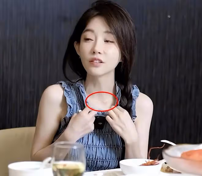 馮提莫得甲狀腺癌晚期:公布傷口與病房照片,女孩要好好愛自己