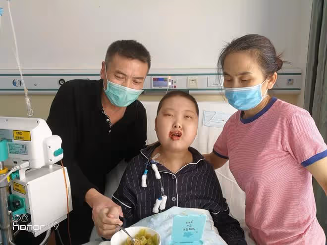 漂亮女孩移植後容顏大變,堂哥賣婚房救妹妹導致女友告吹:不後悔