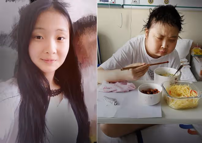 漂亮女孩移植後容顏大變,堂哥賣婚房救妹妹導致女友告吹:不後悔