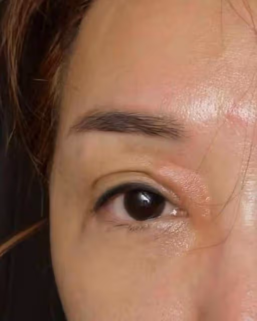 52歲港星定居東莞緊急入院!抑鬱症感冒藥混吃,藥物敏感渾身瘙癢