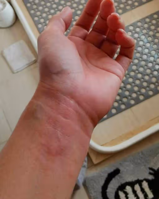 52歲港星定居東莞緊急入院!抑鬱症感冒藥混吃,藥物敏感渾身瘙癢