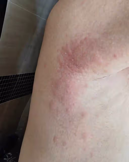 52歲港星定居東莞緊急入院!抑鬱症感冒藥混吃,藥物敏感渾身瘙癢