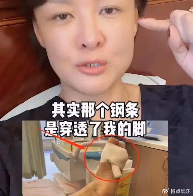 前央視主持突發意外!腳被鋼條穿透鮮血直流,紅臉怒罵無辜粉絲