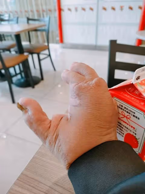 手掌殘缺遭陌生孩童直指很噁心,家人匆忙抱離他說三年才遇一個,誇:身障教育成功!