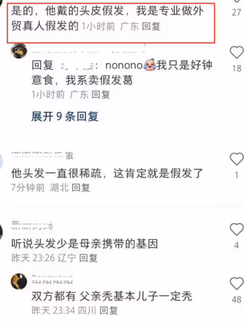 黃曉明《中餐廳》假髮套穿幫,脖子上方頭髮奇怪,像戴了一頂帽子