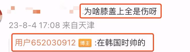 周揚青曬比基尼遊艇照,身材豐腴與海豚共游,膝蓋受傷惹粉絲擔憂