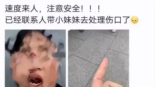 TFBOYS演唱會3個意外：易烊千璽被雷射筆射中眼睛，眼眶立馬變紅