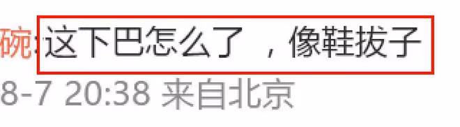 章子怡風波後露面,下巴長到變形,踩10cm恨天高險站不穩