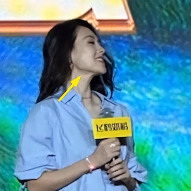 章子怡風波後露面,下巴長到變形,踩10cm恨天高險站不穩