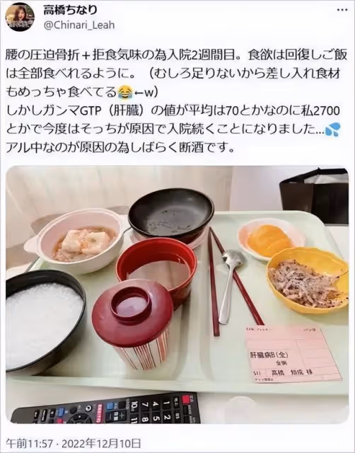 年僅30歲!日本人氣美女大胃王突然死亡,去世前骨瘦如柴!